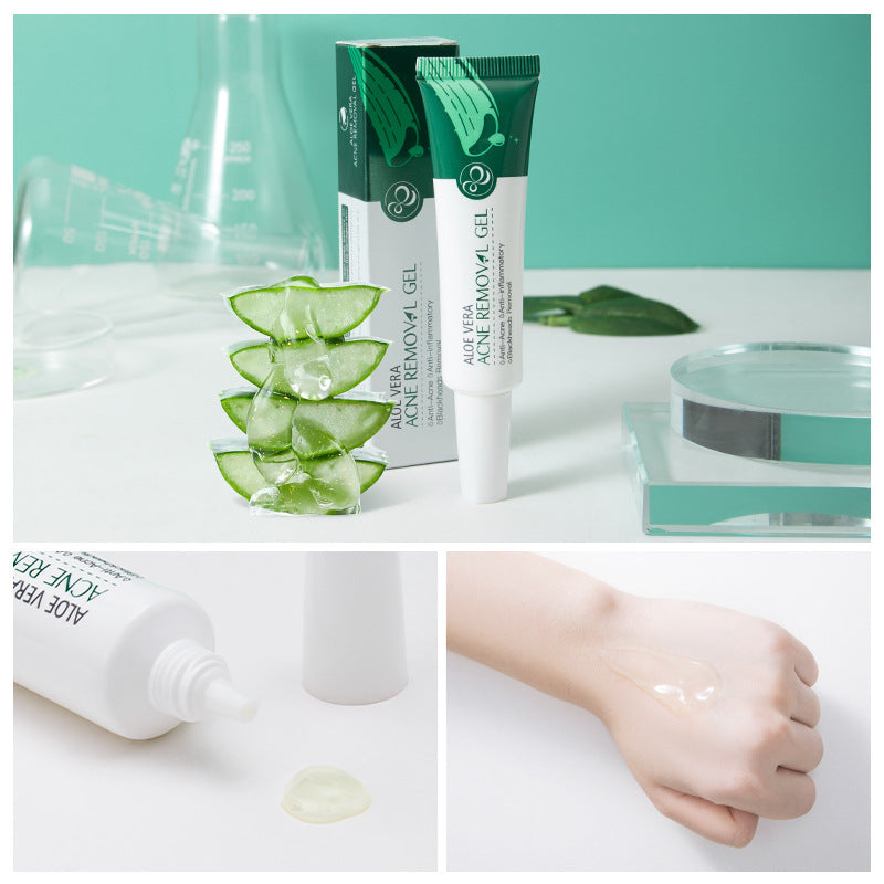 Aloe Acne Treatment Gel Face Cream